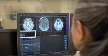 Cover photo featuring an MRI scan being evaluated
